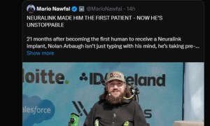 “机械飞升”将成真?Neuralink首例受试者近况曝光 马斯克暗示其将植入双脑机设备